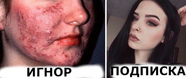 ЖМИ НА СМАЙЛИКИ ,И ПОДПИШИСЬ НА   на  на    на   на  на  на 